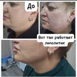 Косметолог, акция! г. Алматы 
1 мл- 43000тг+  чистка