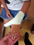 Скотчкасть гипсовый лангета