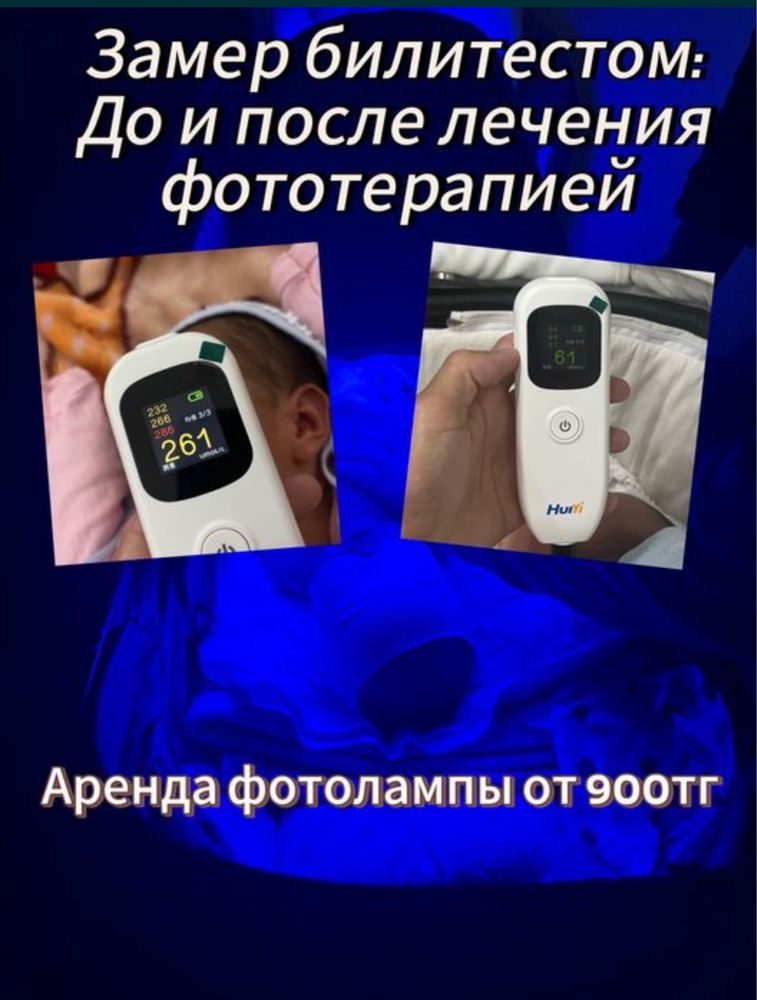 Прокат , Аренда Двойная фотолампа от желтушки фото  желтуха билитест