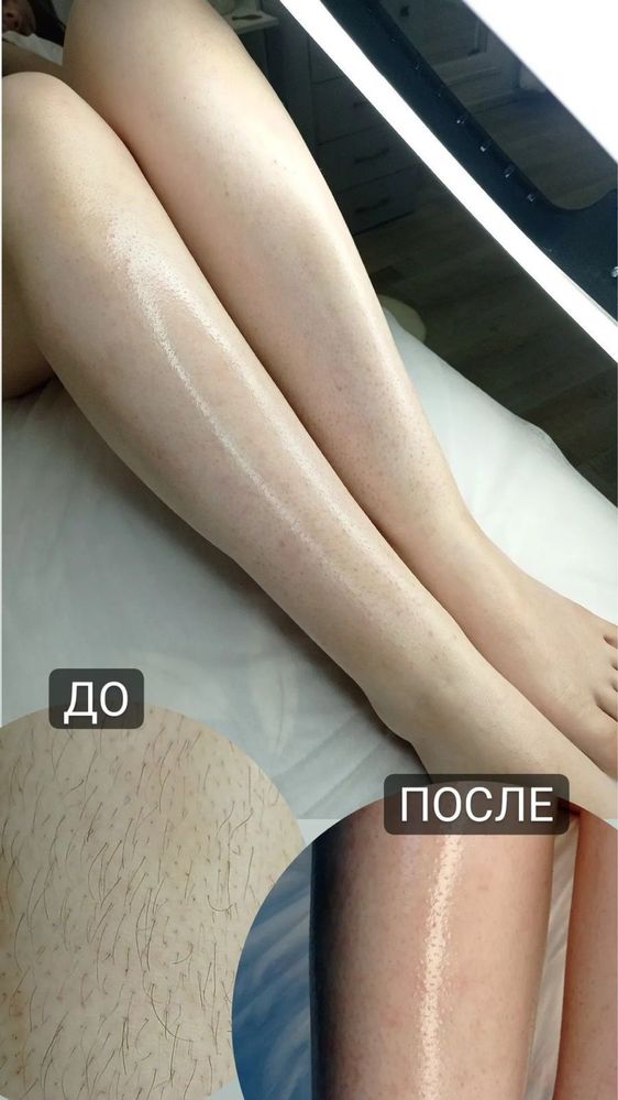 Восковая депиляция,шугаринг