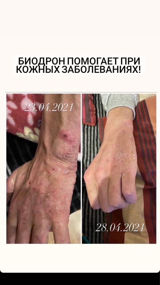 Биодрон Biodron (гуминовые,фульвовые кислоты)