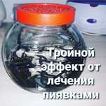 Пиявки 1100 тенге  медицинские