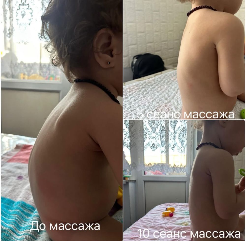 Профессиональный детский массаж ЛФК, мануалист, с выездом на дом.