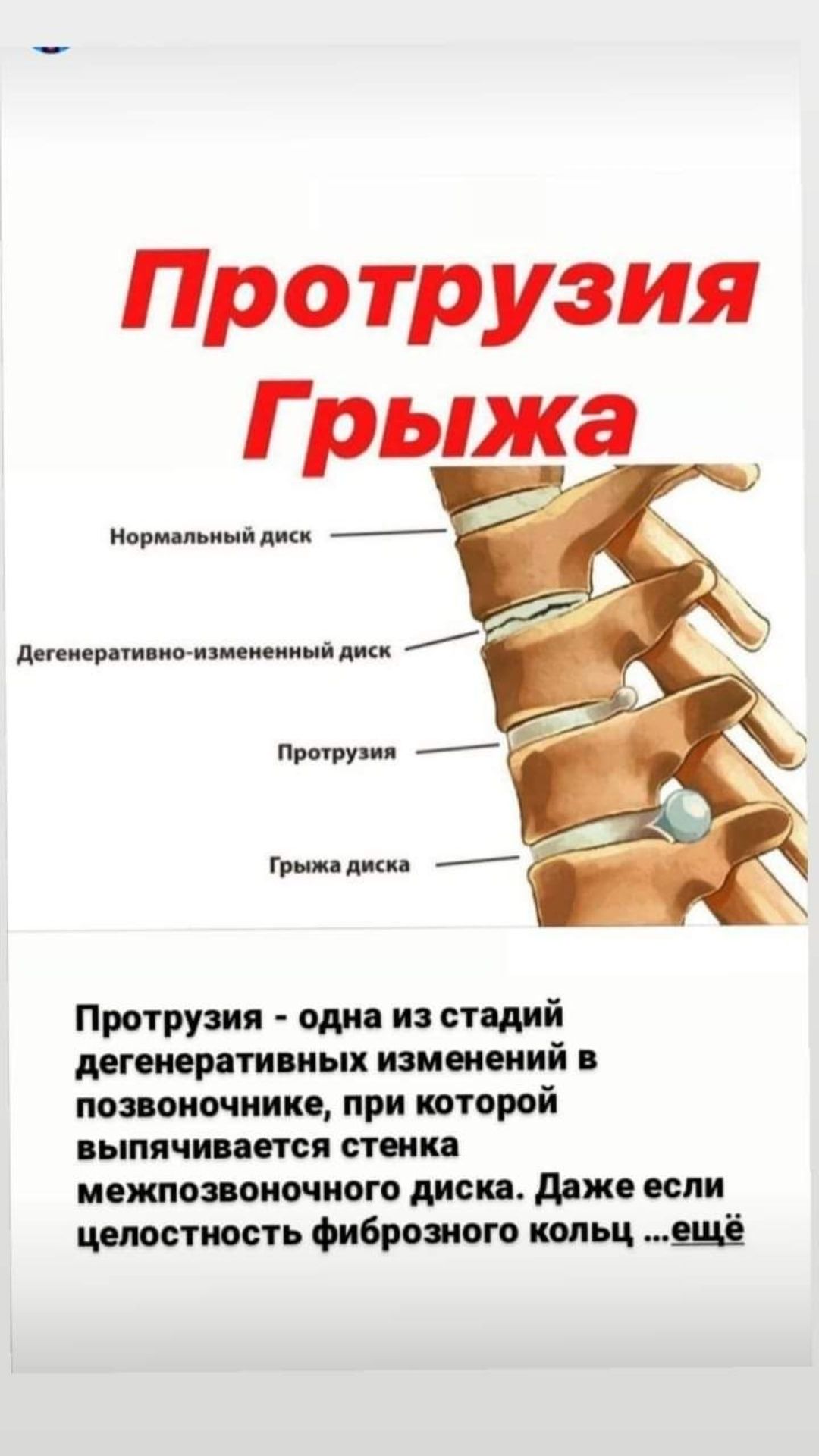 Хиджама Алматы есть также с выездом