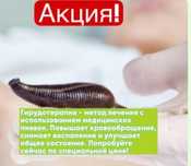 Лечение пиавками
