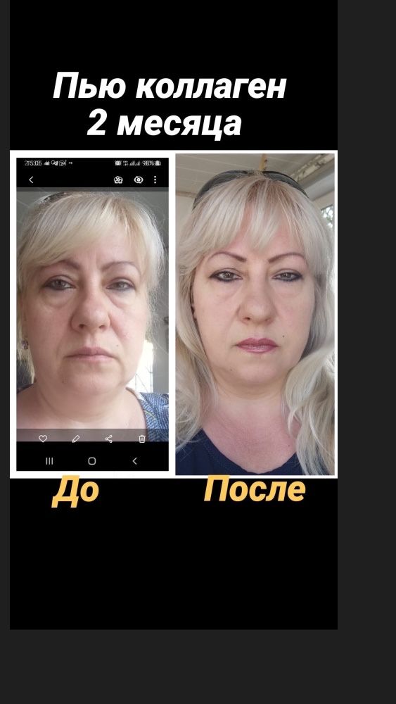 коллаген пищевая добавка ( для кожи волос и ногтей)