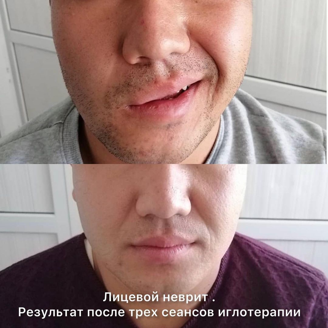 Иглотерапевт, Остеопат, Мануальный терапевт, Уролог массажист, хиджама