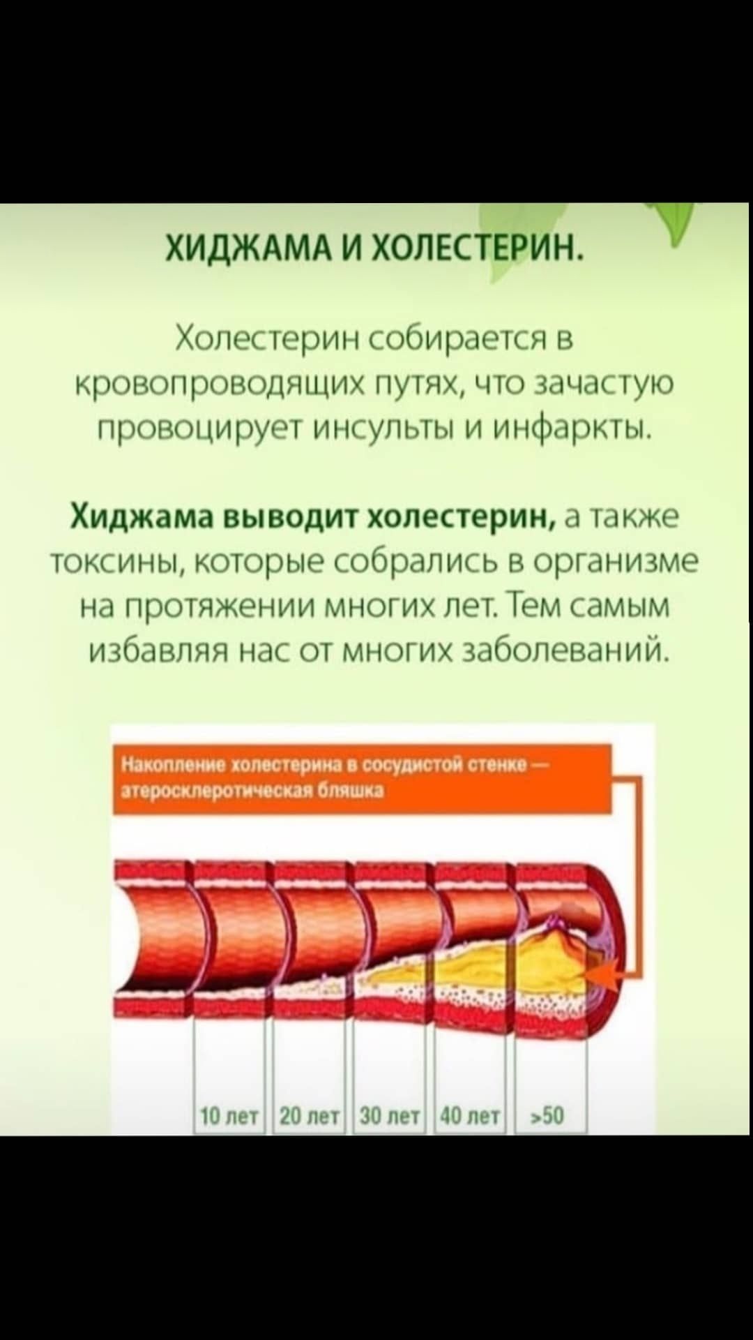 Хиджама Алматы есть также с выездом