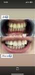 Студия косметического отбеливания зубов M.Smile