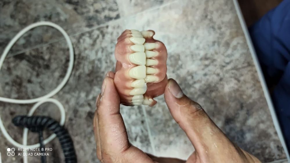 Услуги зубного техника