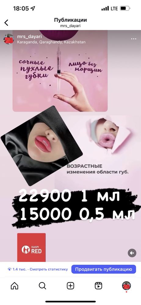 Косметолог . Увеличение губ