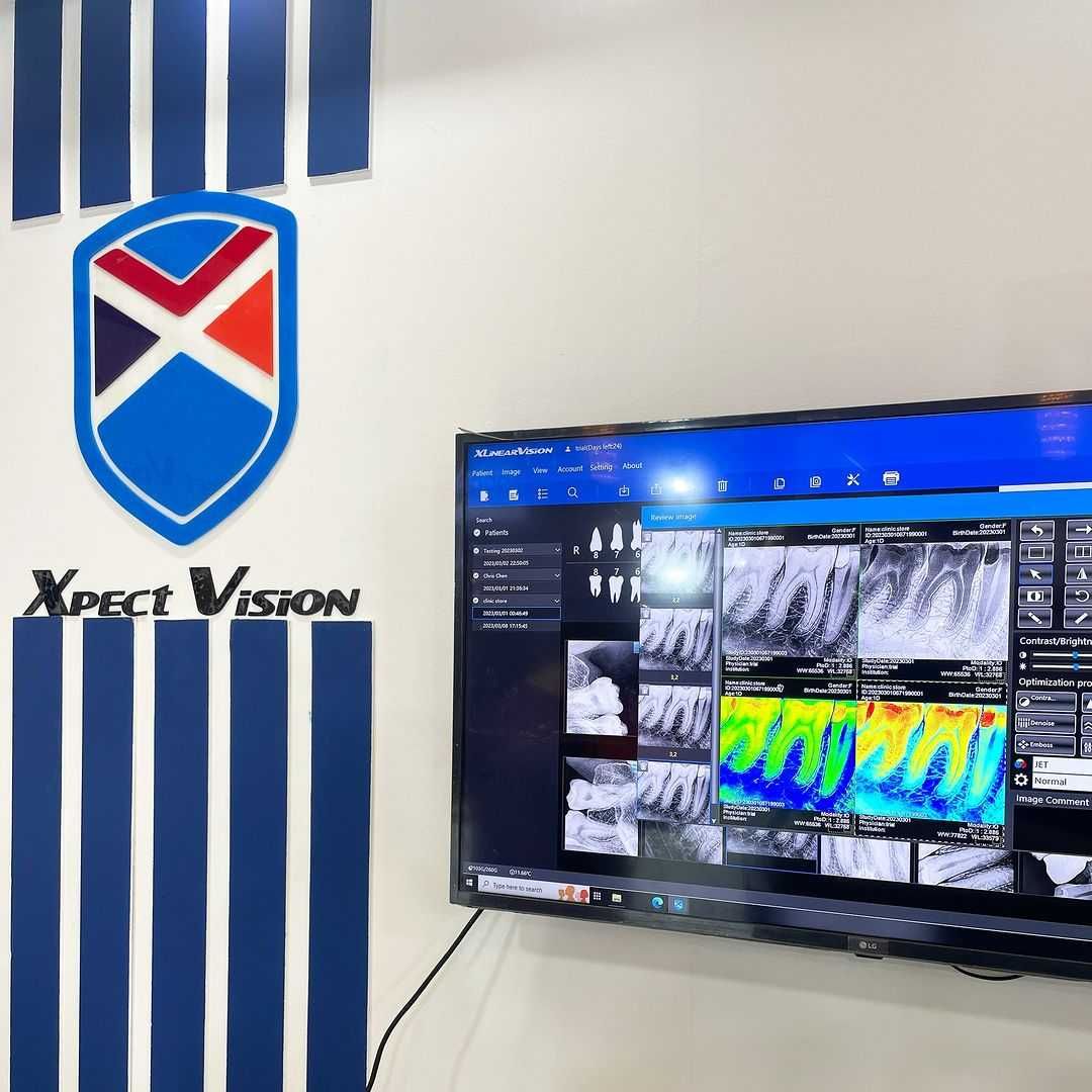 Дентальный портативный рентген XVBeam2000