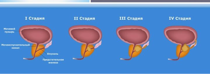 Забота о простате