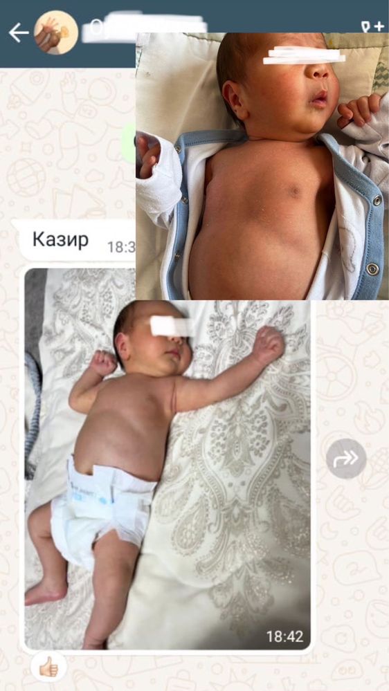 Фотолампа от желтушки. Билитест. Билирубин. Аренда фото лампы. Люлька