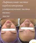 Чистка лица, уходовые процедуры, массаж лица