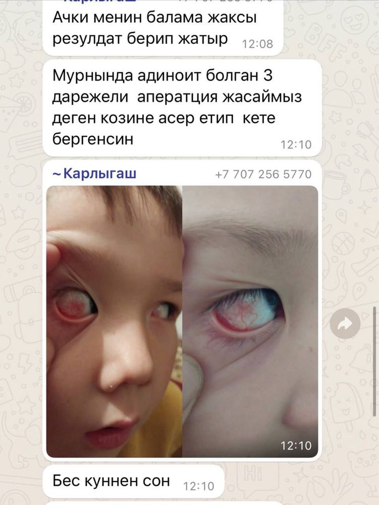 Графен емдік очки