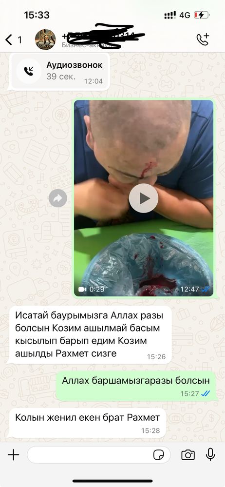 Шертпе и хиджама в городе Алматы и на выезд
