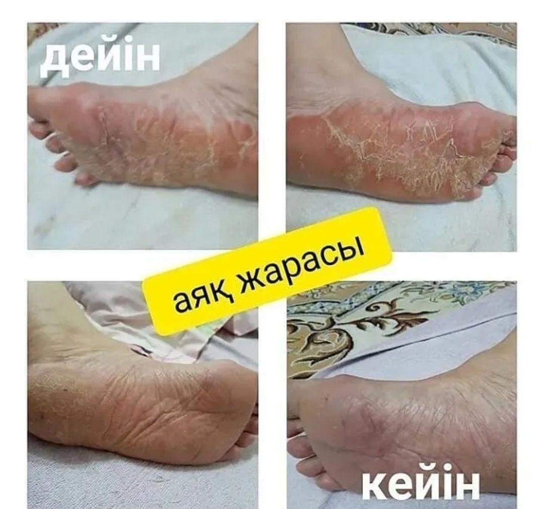 Қара сақар сабын