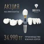 Акция на установку имплантов