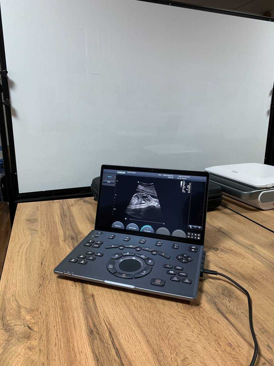Портативный УЗИ-аппарат CHISON SonoBook 7