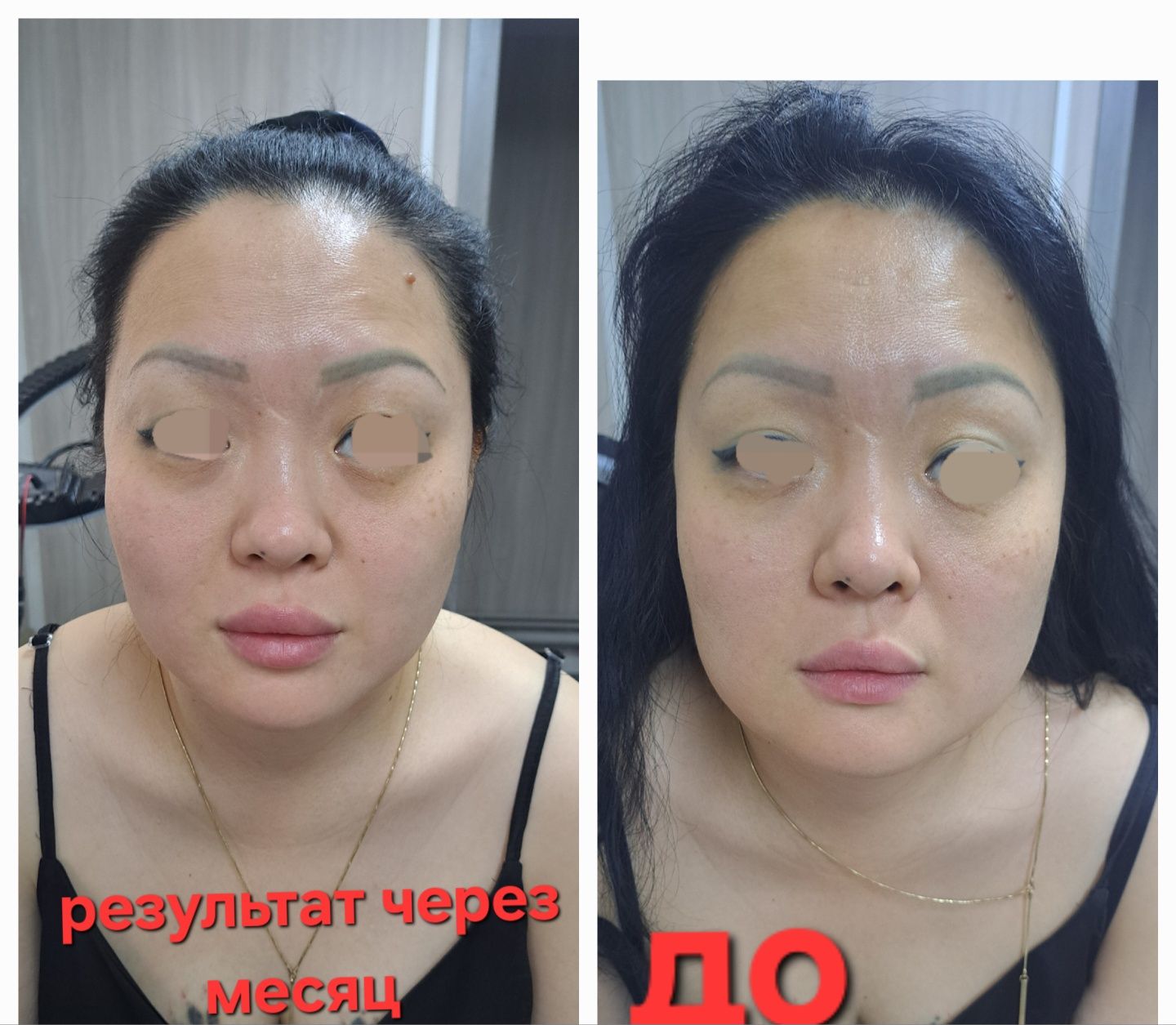 Косметолог,  чистка,ботокс,  губки, г. Алматы