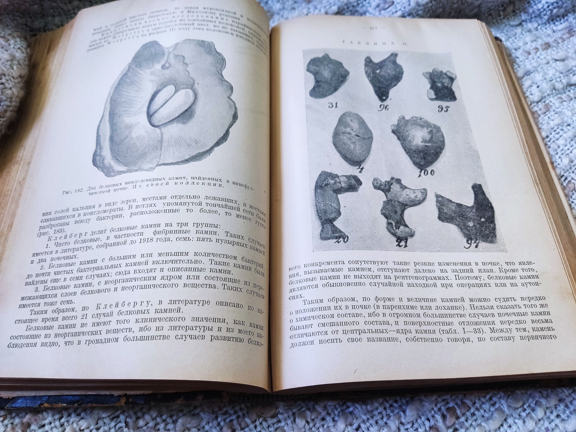 Книга Хирургия почек и мочеточников.С.П.Федоров,1925г.