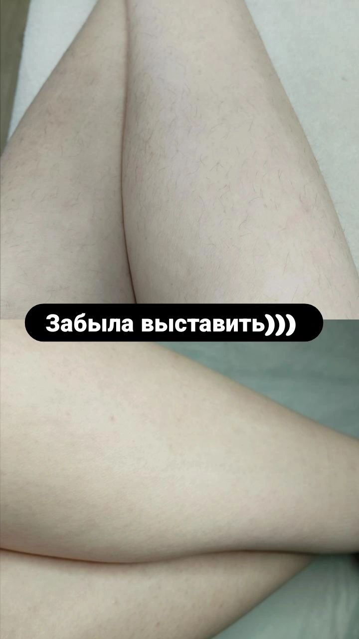 Шугаринг          .