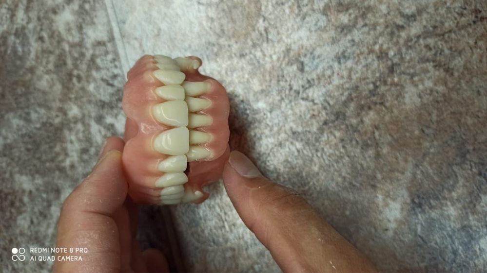Услуги зубного техника
