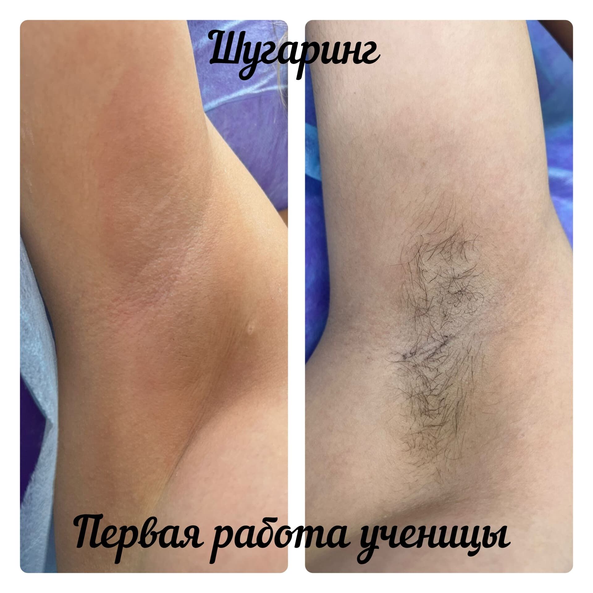 Курсы Шугаринга по Акции