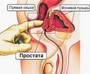 Урологический массаж простаты и консультация уролога