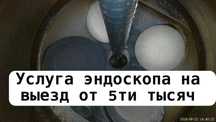 Эндоскоп эндоскопия двигателя