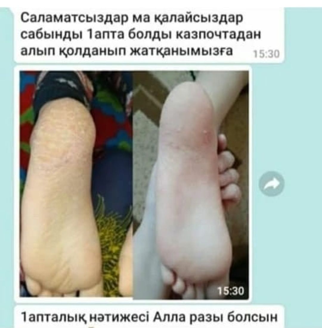 ҚАРА САҚАР сабын тері ауруларына таптырмас ем