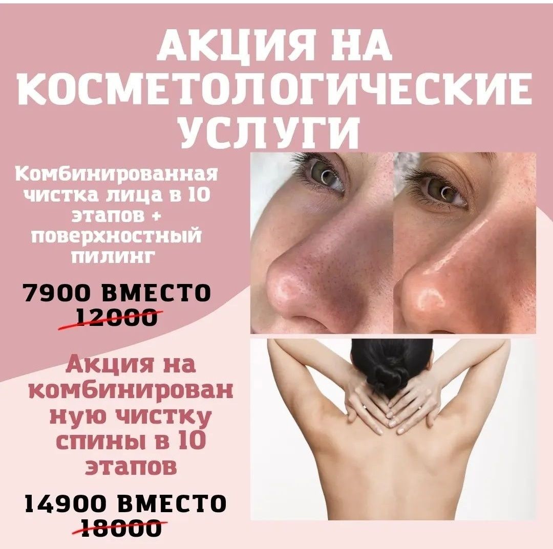 Акции на чистку лица, чистку спины!