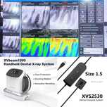 Комплект - Рентген аппарат XpectVision XVbeam2000 +  визиограф XVS2530
