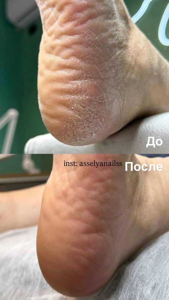 Маникюр, педикюр, наращивание