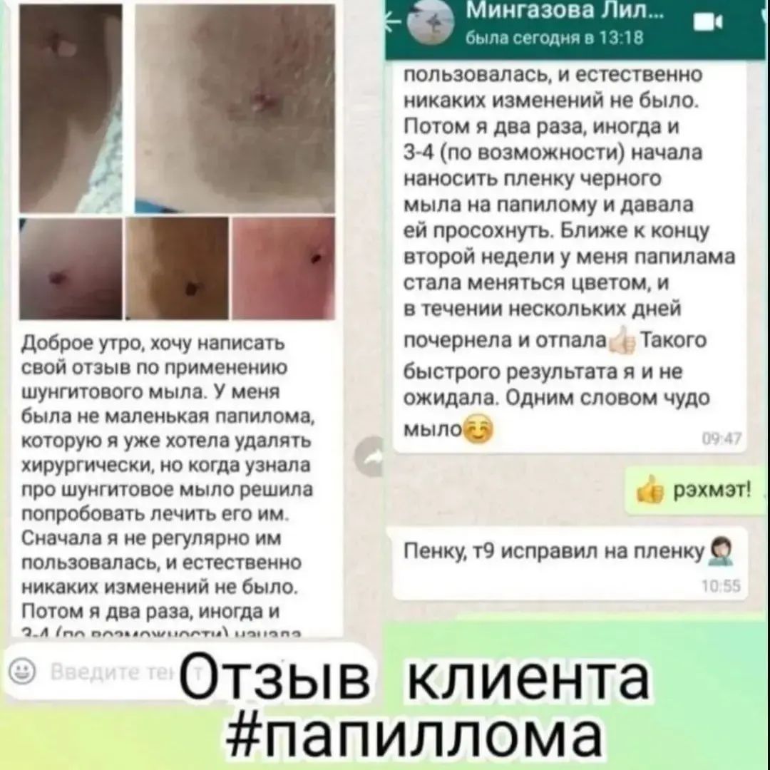 Лечебное Шунгитовое мыло