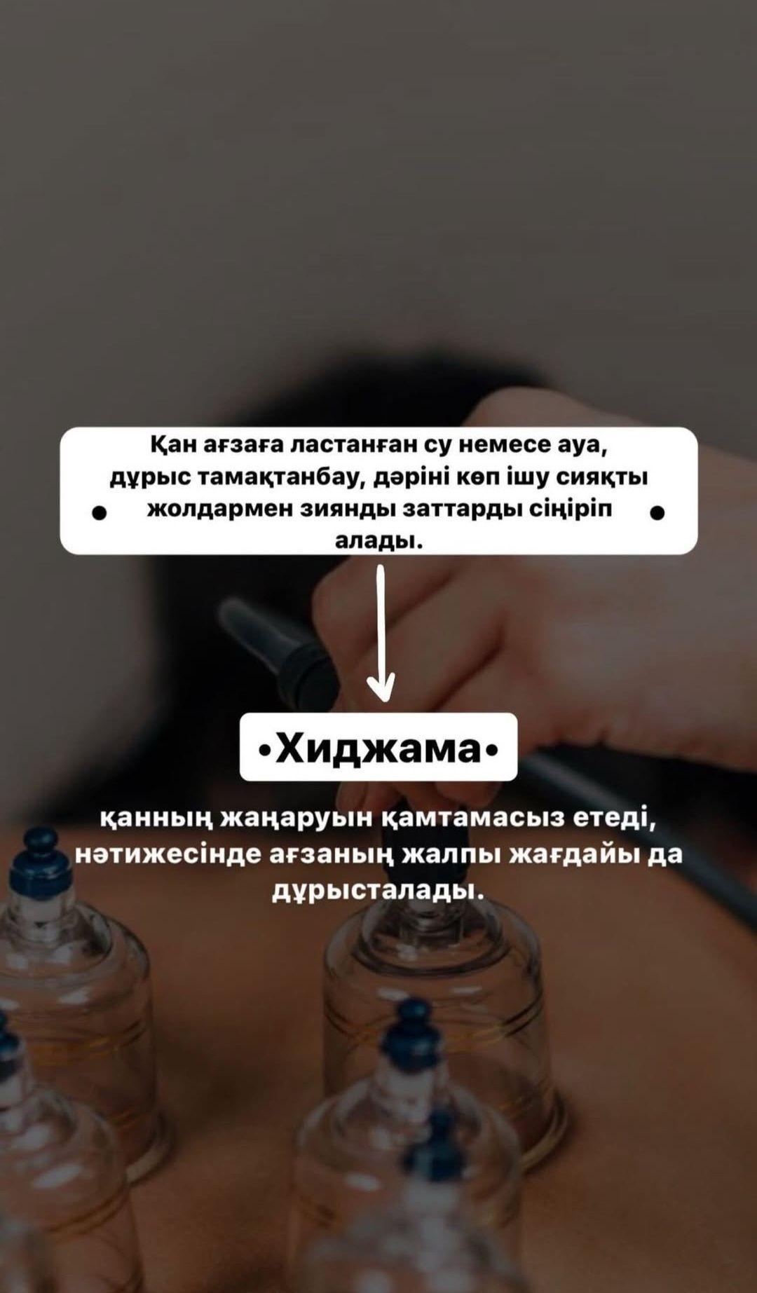 Хиджама Шымкент!!!