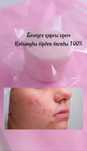 Лечебный крем от прыщей.