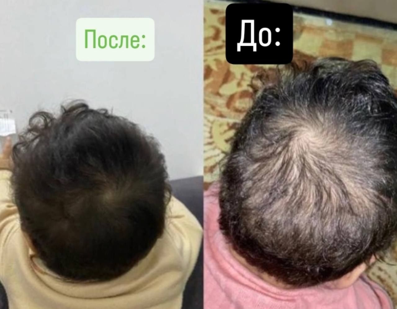 Натуральное средство от выпадения волос.