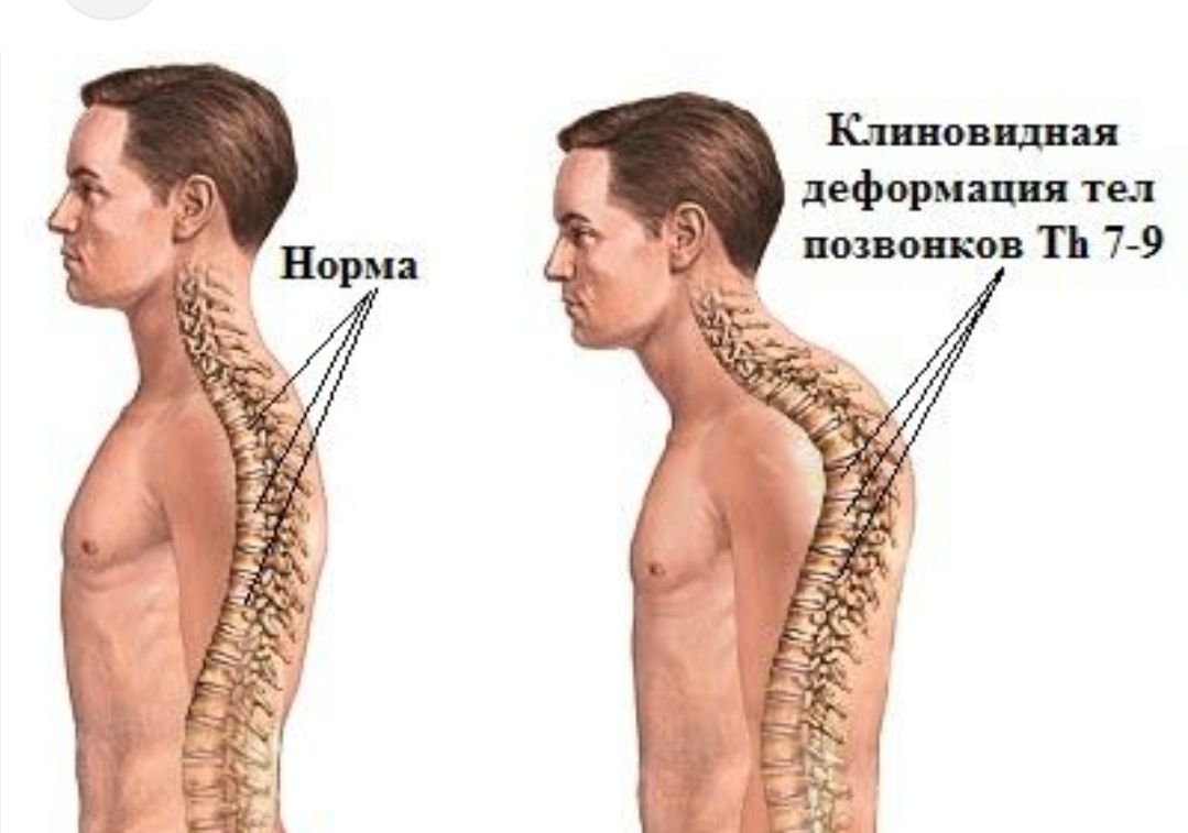 Корсет карсет для осанки иыкка