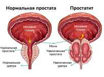 Улучшение потенции
