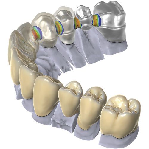 Exocad/ЗShape/Blender For Dental/BlueSkyPlan/Realgude/Invivo/Ezdent