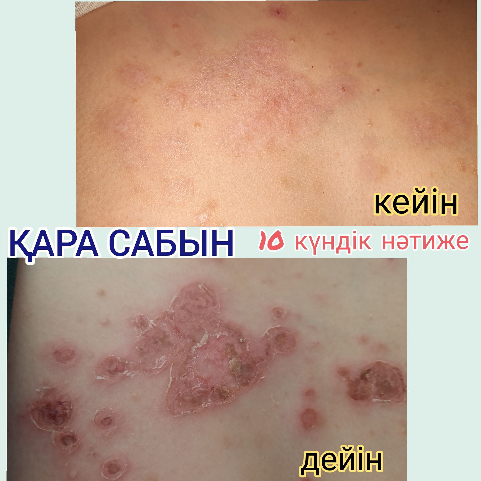 Тері ауруларына қолдан қайнатылған емдік сабын.